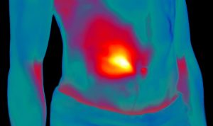 How to Reduce Inflammation Through Diet for Better Health